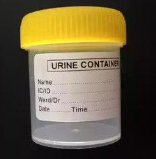CAD / UG Cetakan Injeksi Medis Kustom Urine Collector Mould OEM